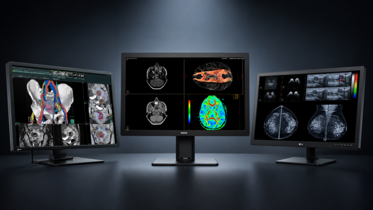 medical monitors for radiology workstation setup